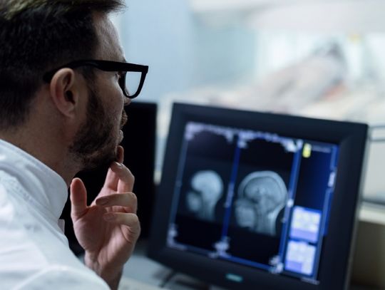 Coraz więcej zachorowań  na nowotwory w Wielkopolsce